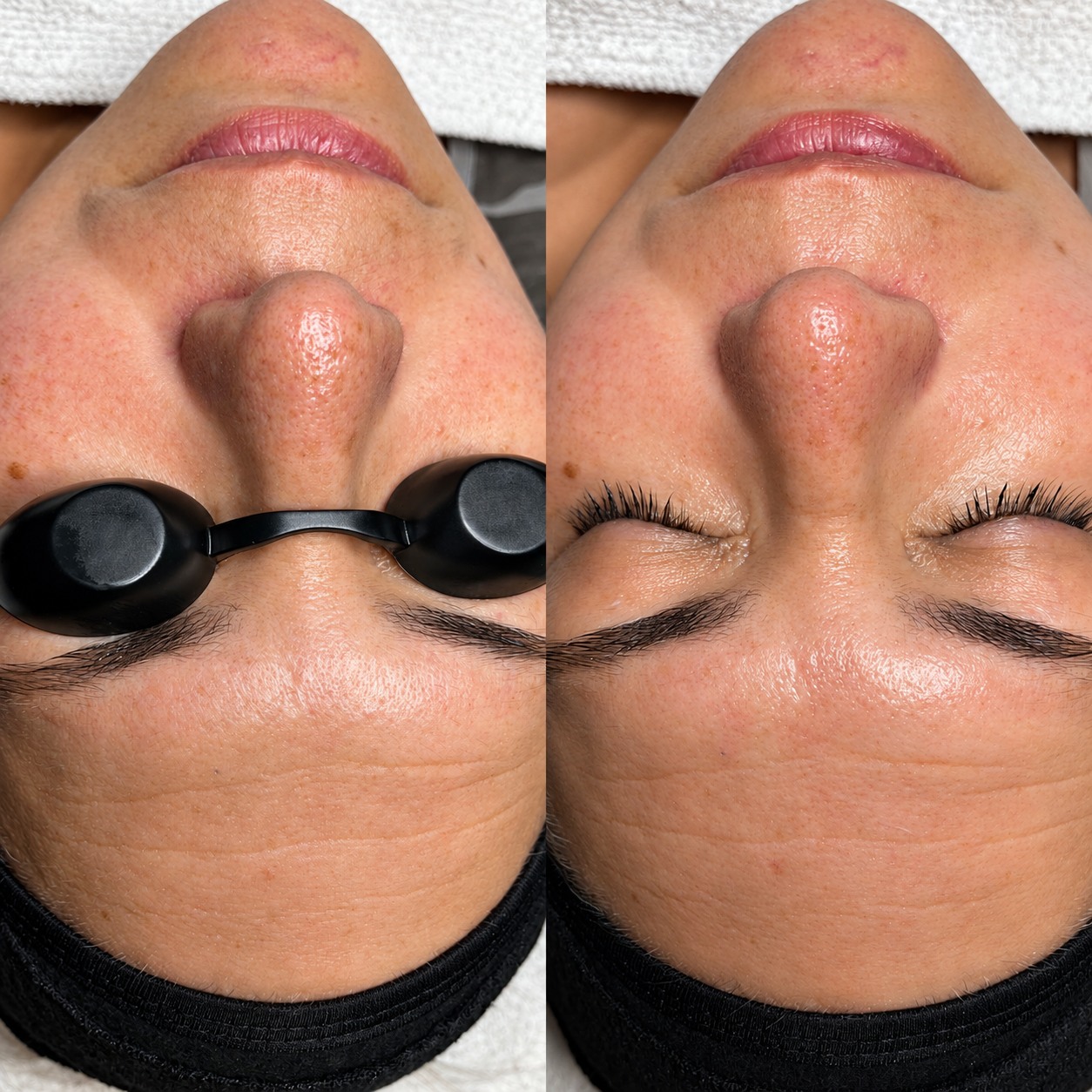 Before and after view of a client’s facial skin treatment at Bare Haven Wax Studio